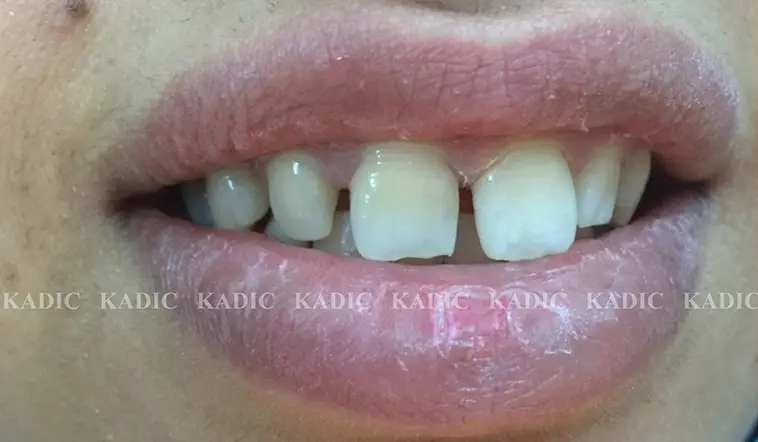 Before Image